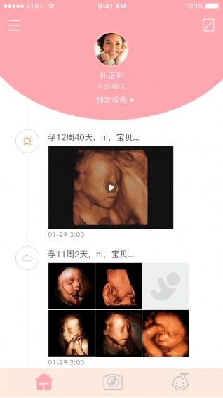 胎儿相机iphone版 V2.0